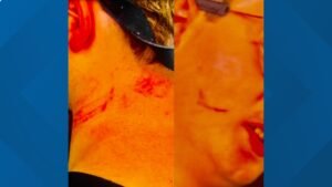 Los padres se quejaron del abuso de estudiantes de necesidades especiales en JM Robinson