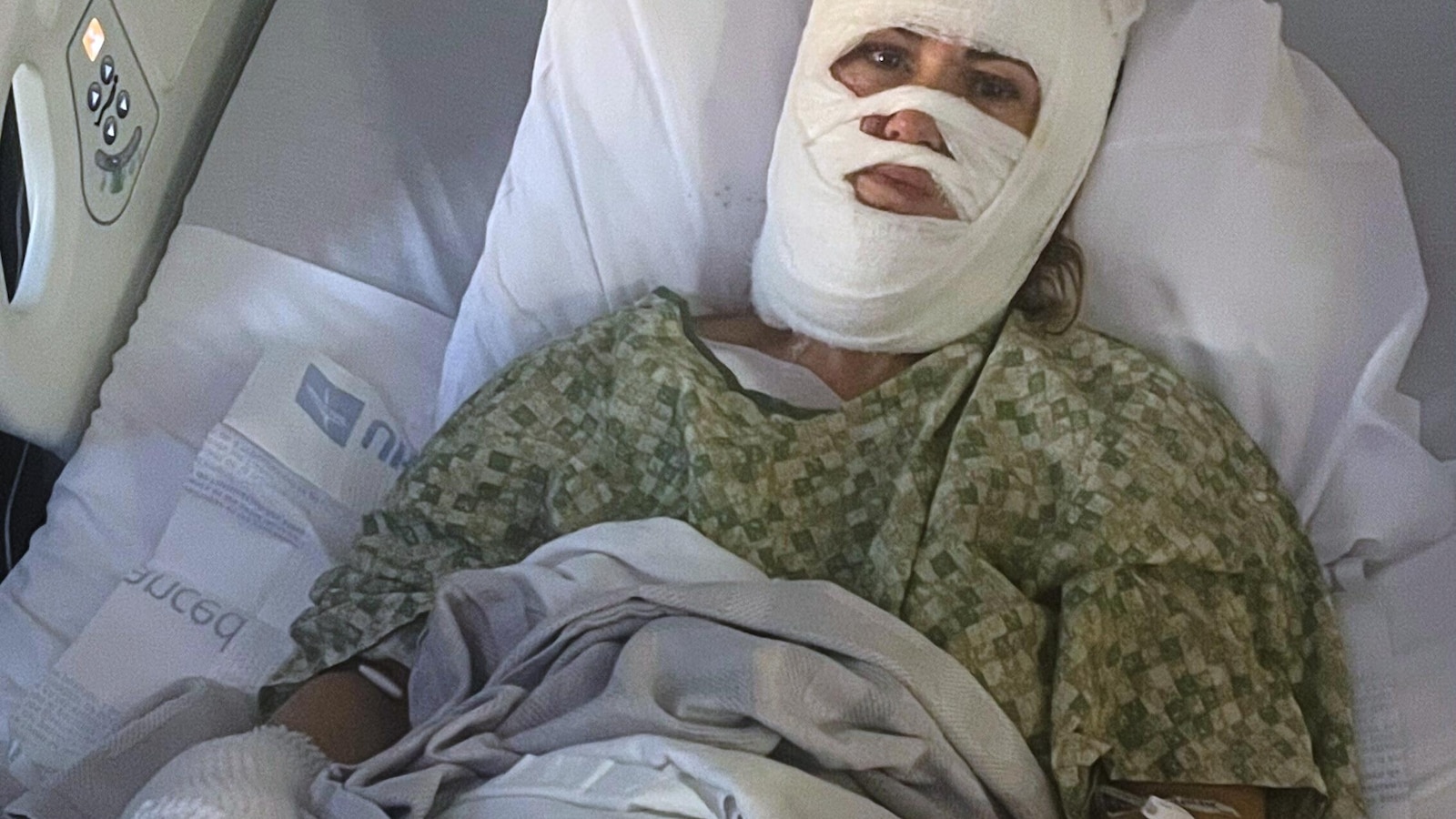 Mujer gravemente quemada en ataque químico en parque de Georgia