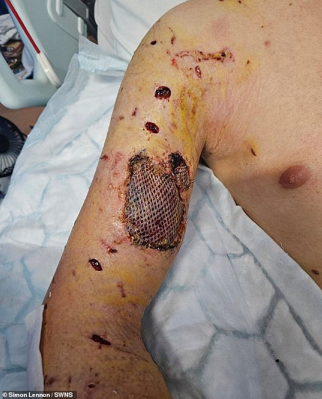 105898641-15505635-Joseph_Bennett_21_was_repeatedly_bitten_and_had_his_bicep_torn_o-a-14_17696125321.jpeg