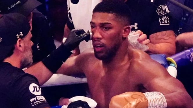 615038e8a3df0-anthony-joshua_665_374.jpg
