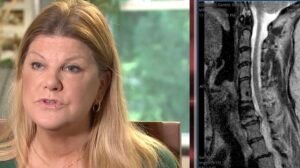 La madre de Nueva Jersey estaba vestida y tenía una vía intravenosa cuando el hospital intentó cancelar su cirugía. Terminó ganando 126.000 dólares por ello.