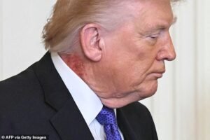 Trump enfrenta un nuevo problema de salud mientras los espectadores buscan problemas “malos” en su cuello