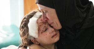 Para un cirujano que trata a niños heridos en el Líbano, sus horribles heridas le traen recuerdos de Gaza