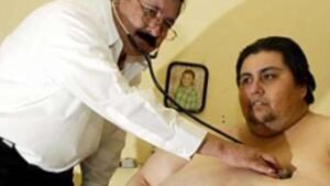 Las tasas nacionales de obesidad están en aumento