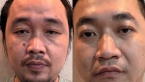 Apartamento de lujo convertido en guarida de metanfetamina, ¡arrestan a la mano derecha de Co Erwin! El número de ‘El Doctor’ sigue siendo enorme