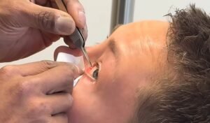 La estrella de UFC Rose Namajunas comparte un inquietante clip de cirugía después de un brutal golpe en el ojo durante la pelea