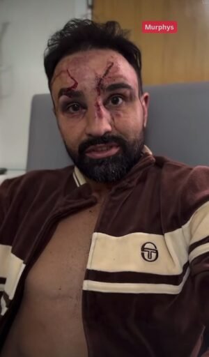 Un hospital del NHS responde a un boxeador estadounidense que lanzó un discurso impactante sobre su atención médica después de atacar al personal al que “no se le permite trabajar con animales de granja” en los EE. UU. ¡Y él está luchando en el Reino Unido este fin de semana!